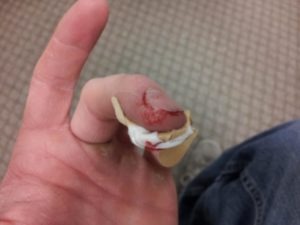 “I only had to put on a band-aid.”