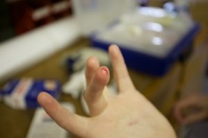 “I only had to put on a band-aid.”