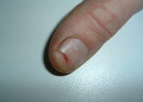 “The blade stopped immediately.”