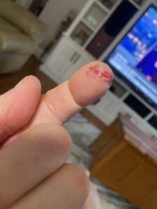 Harv Weiler Finger Save